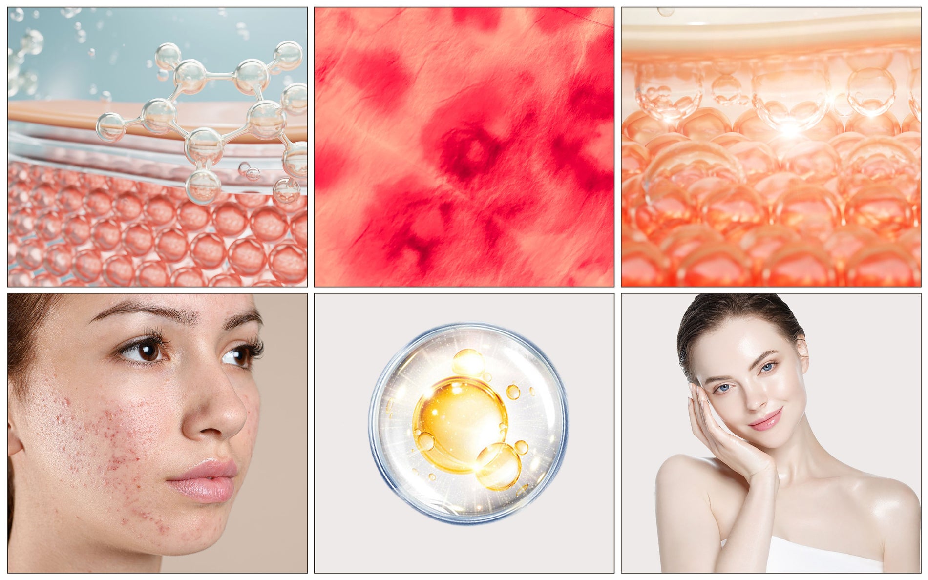 Red Light Therapy for Hyperpigmentation: How Does It Work?